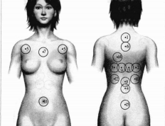 牛皮癣白癜风的治法