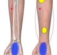 手麻手掌手指问题