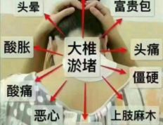 萨满48穴取穴点。萨满罐取穴方法参考。