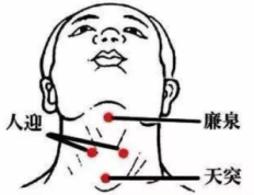 甲状腺问题的拔罐思路