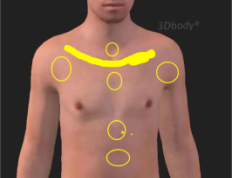 肺部问题，肺结节，哮喘，肺气肿等等加案例参考。