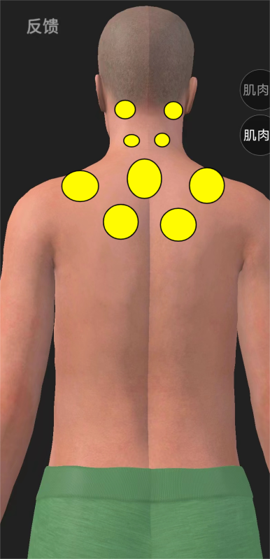 颈椎病富贵包头晕头疼等取穴