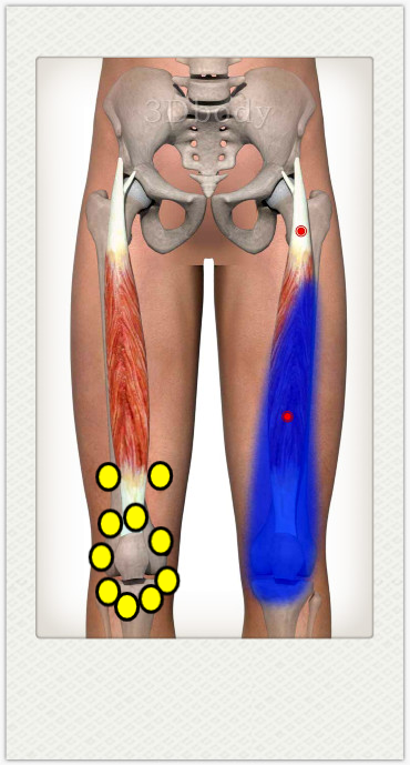 膝盖疼滑膜炎问题处理解说