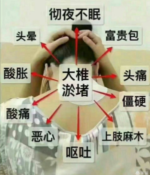 萨满48穴取穴点。萨满罐取穴方法参考。