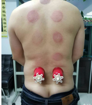 萨满48穴取穴点。萨满罐取穴方法参考。