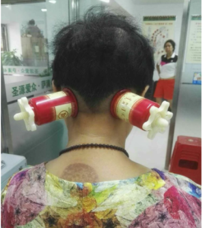 萨满48穴取穴点。萨满罐取穴方法参考。